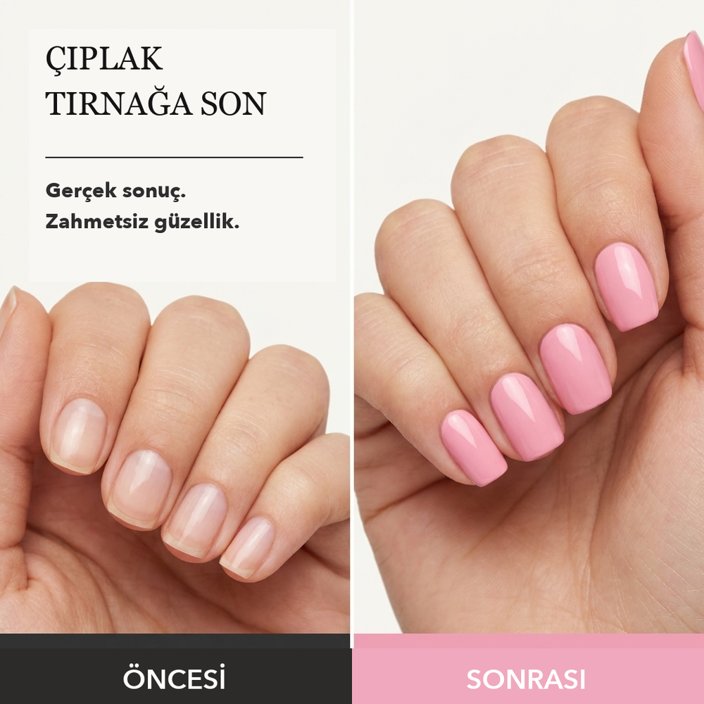 PLACEHOLDER gecici gorsel - degistirilecek